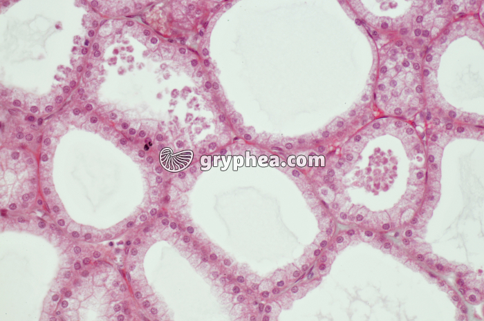 Glande lacrymale x100 - gryphea.com